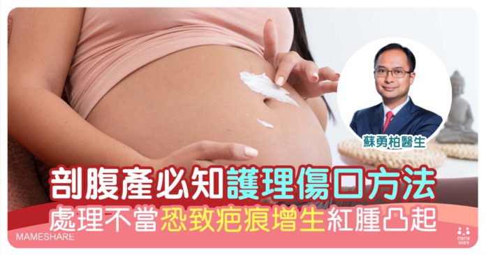 剖腹產傷口護理貼士-3大除疤方法防止疤痕增生