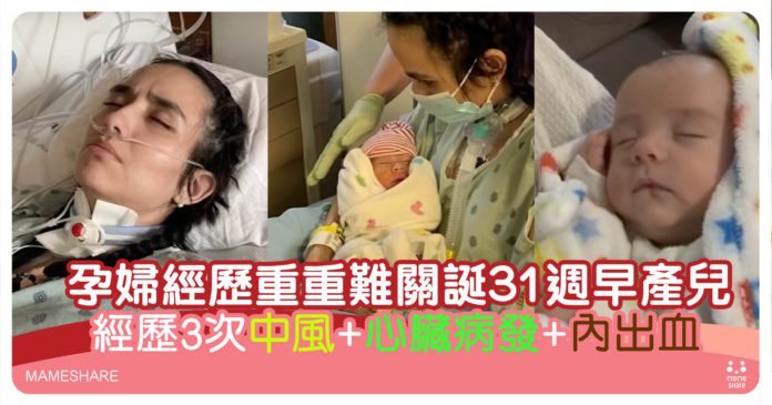 染疫孕婦經歷3次中風及心臟病發-終成功誕下31週早產嬰兒